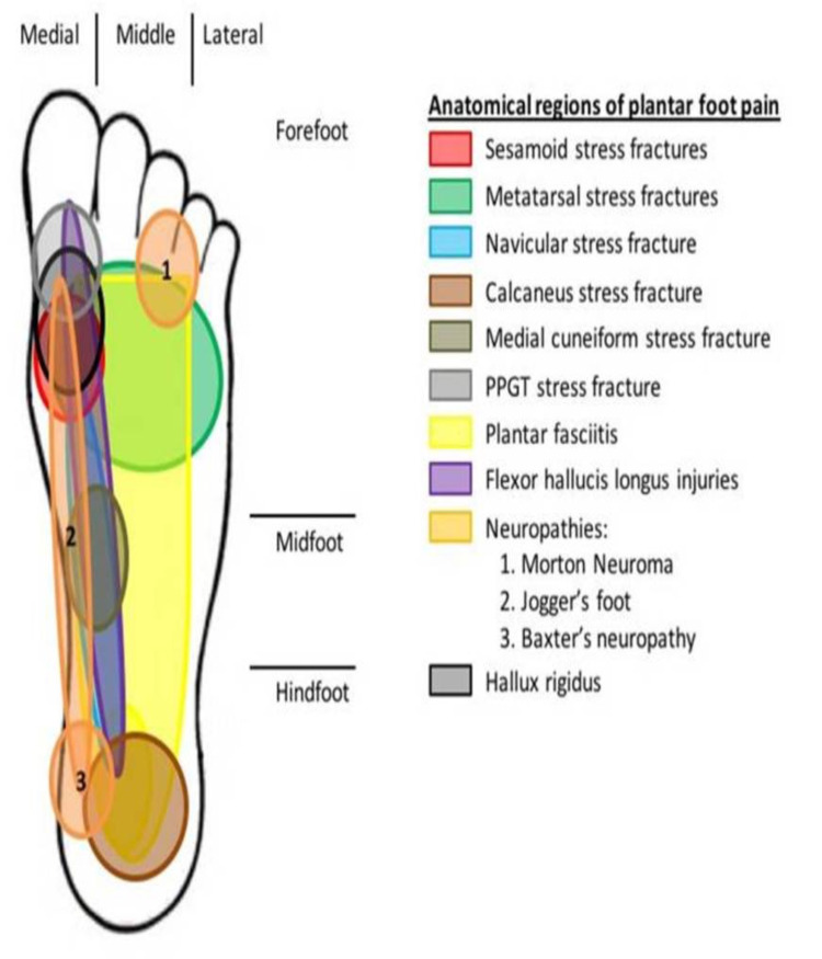 fascia plantar